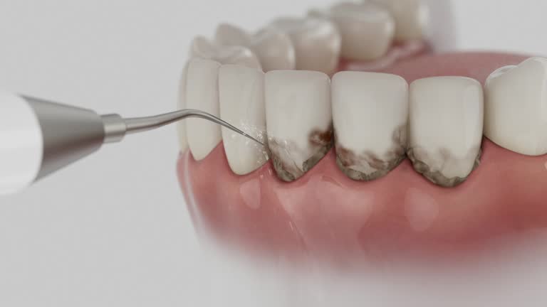 Reliable Dental contractor in Salem, MA by Dentist Open Now